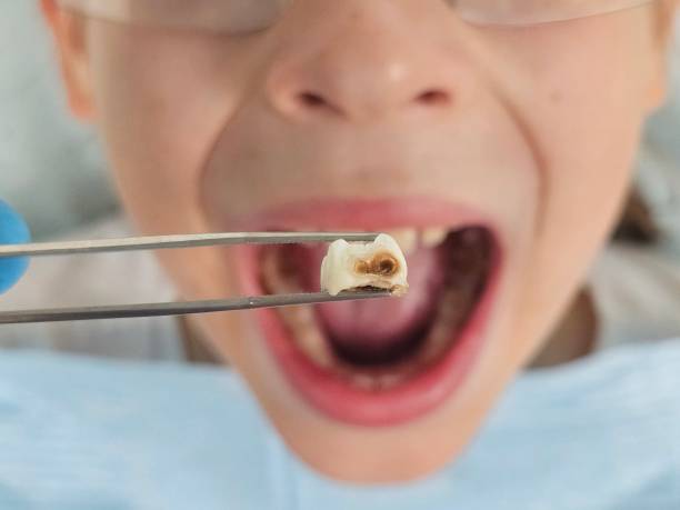 Best Emergency Dental Surgery in Caney, KS
